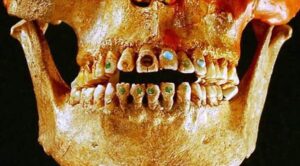 1,600-Year-Old Elongated Skull with Stone-Encrusted Teeth Found in Mexico Ruins