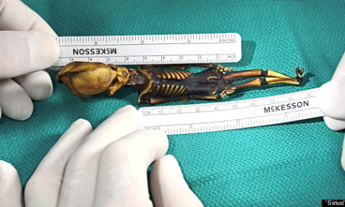 “Alien” skeleton found in Chile actually human fetus with a rare bone disorder