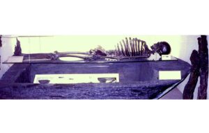 The Gristhorpe Man: A Bronze Age Skeleton with a Story to Tell
