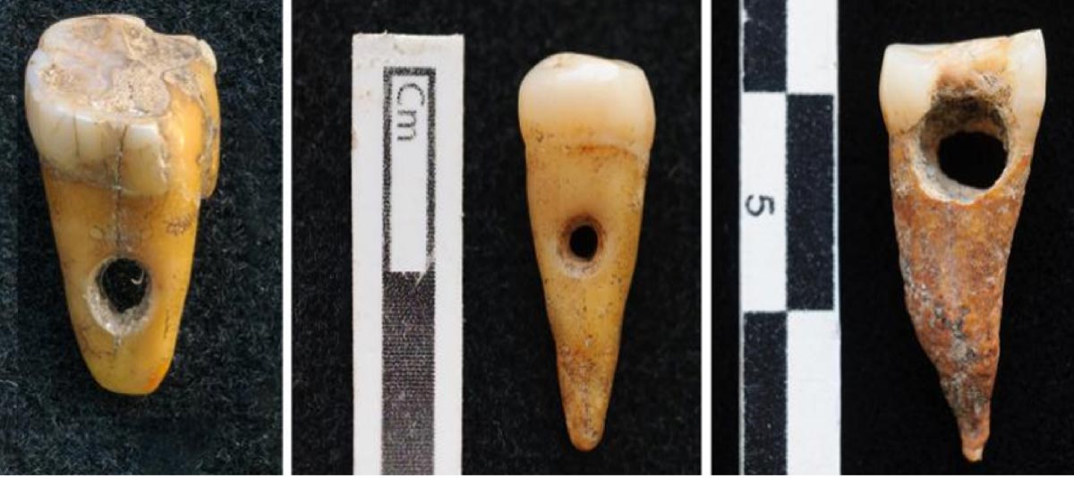 Bizarre Stone Age jewellery made from human teeth found in the ancient Turkish city